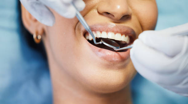 Best Emergency Tooth Extraction in Greenfield, OH